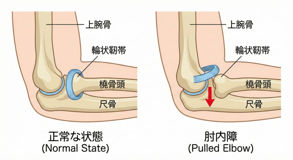 大府市からでも行けるARK接骨院の肘関節の図説です