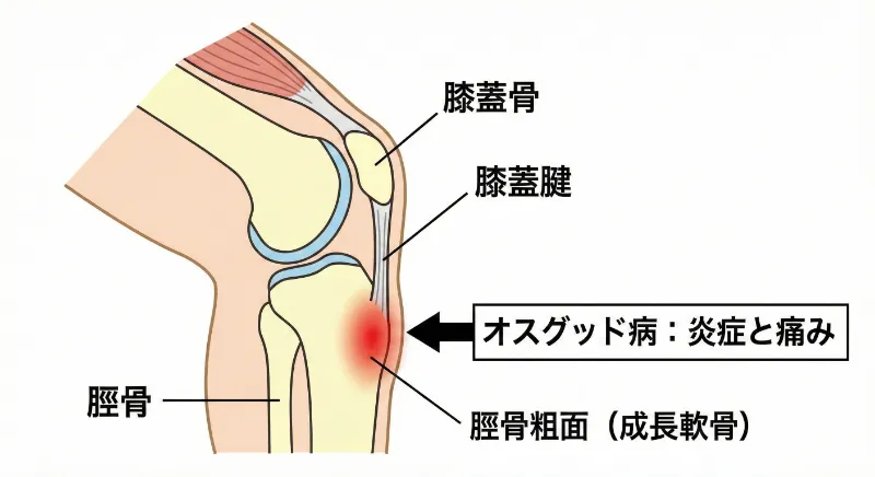 オスグッドの図説