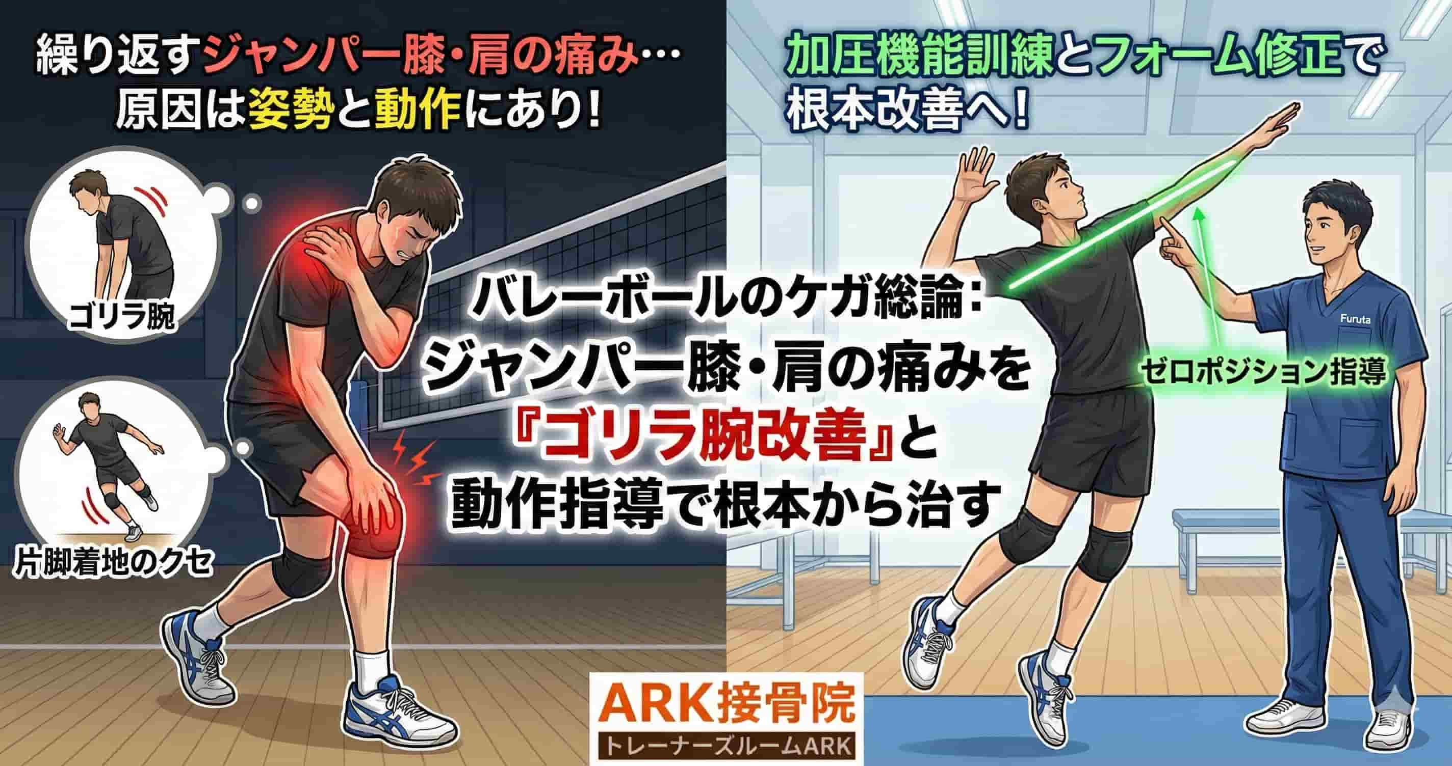 東海市でバレーボールの体の痛みならARK接骨院