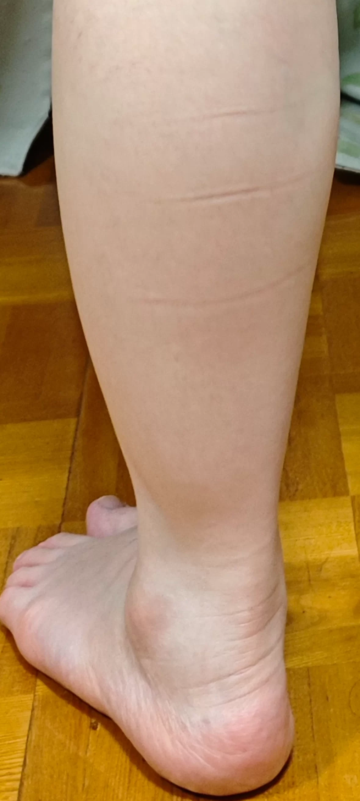 東海市ARK接骨院でアキレス腱の細かな観察をする様子