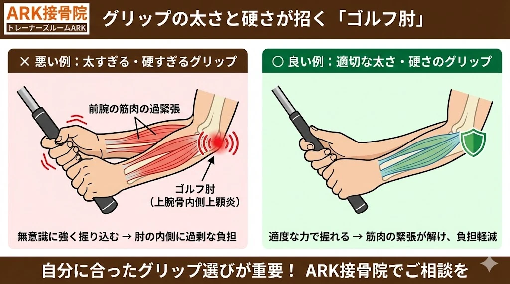 東海市で悪いグリップで招くゴルフ肘
