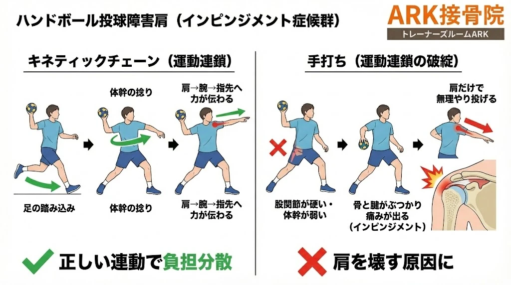 大府市でハンドボールの肩の痛みの解説図