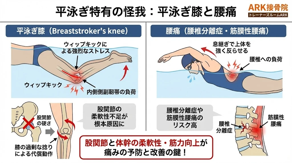 知多市で平泳ぎの膝の痛み解説図