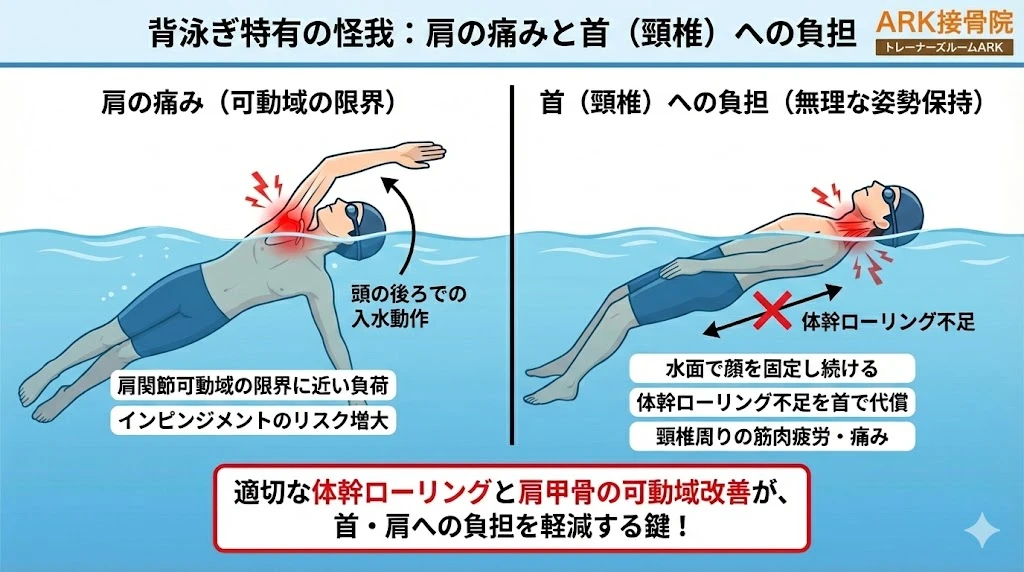 東海市で背泳ぎによる首の痛みの解説図
