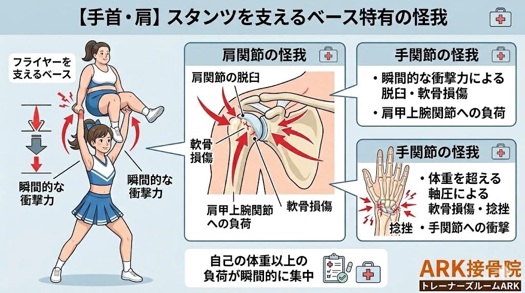 東海市でチアダンスでの手首の痛み解説図