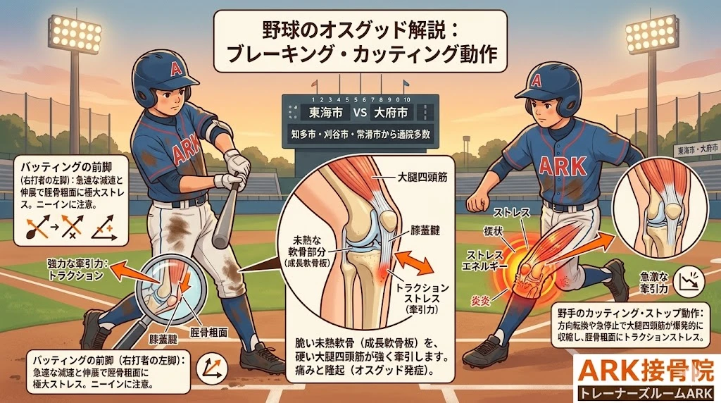 大府市でオスグッドの膝の痛みは野球のバッターに多い