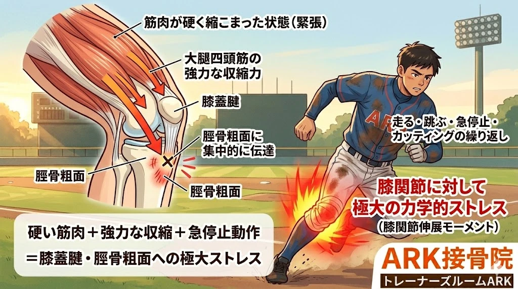 大府市で野球dの膝の痛みはオスグッドかもしれない