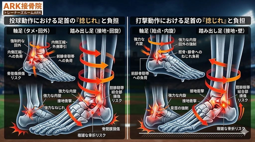 知多市で足首の痛み捻挫の解説野球にて