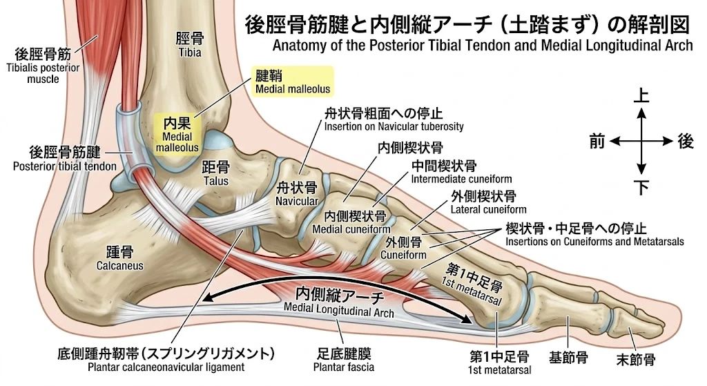 東海市・大府市で解説する慢性的な足首捻挫による後脛骨筋機能不全と土踏まず（アーチ）崩壊のメカニズム図
