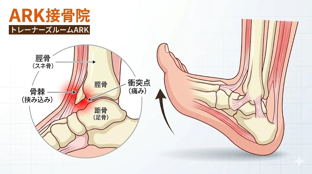 フットボーラーズアンクルの足首の痛み解説