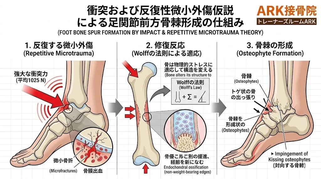 大府市で足首の痛みフットボーラーズアンクルの解説図