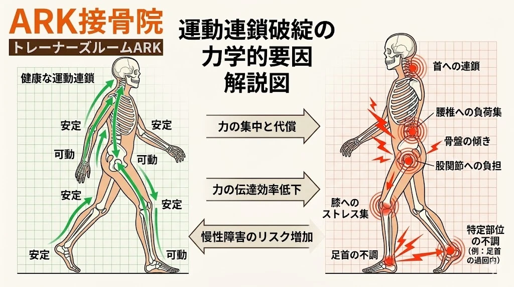 大府市で運動連鎖の破綻による身体の痛み