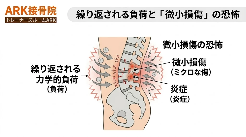 知多市で腰が痛いのは筋膜性腰痛かもしれない