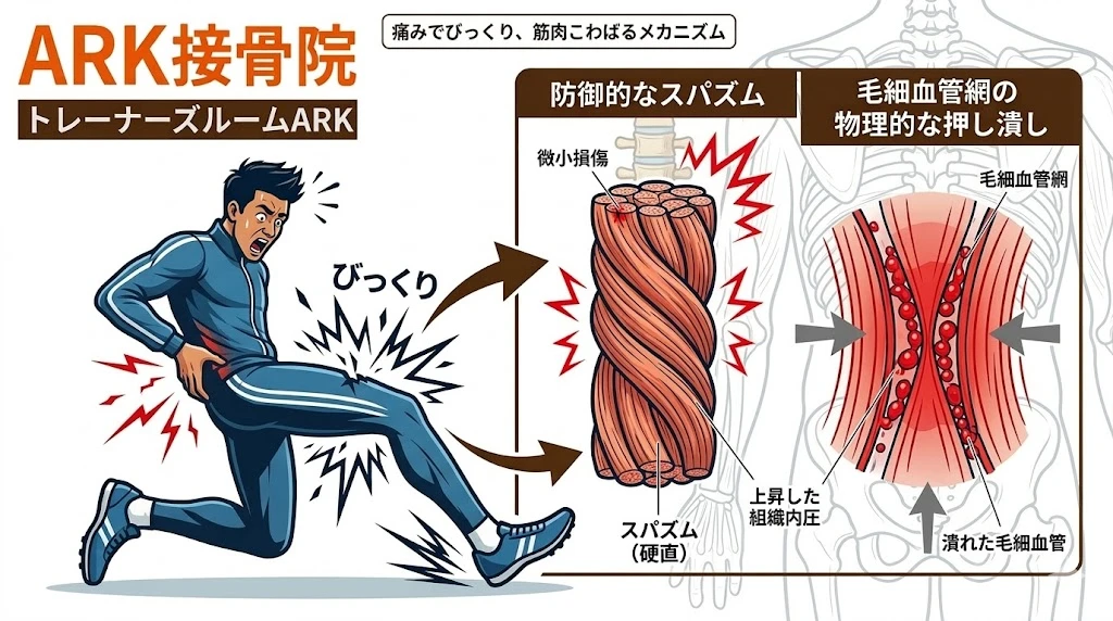 東海市で腰痛の原因は筋膜性腰痛かも