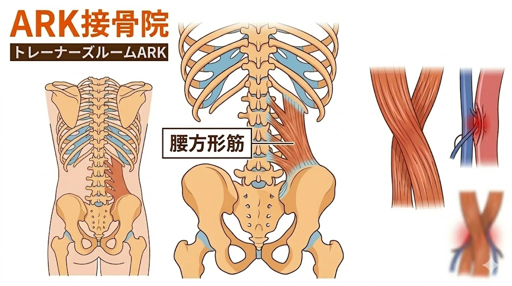 知多市で腰痛の原因、腰方形筋の図説