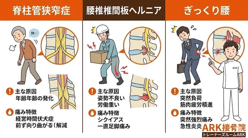 大府市で立ったり座ったりが痛いぎっくり腰