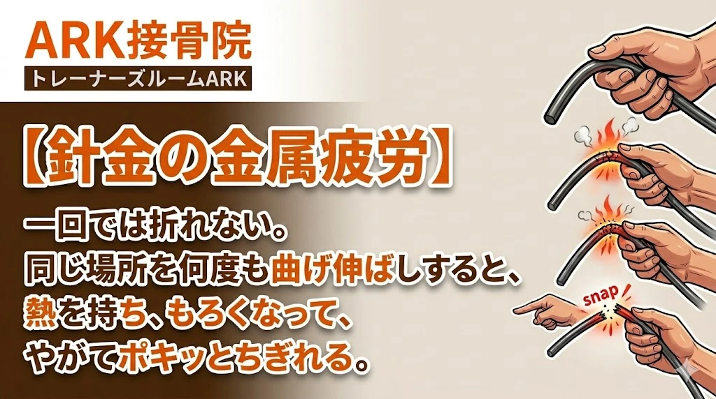 大府市で疲労骨折の痛みに対するアクティブなリハビリ