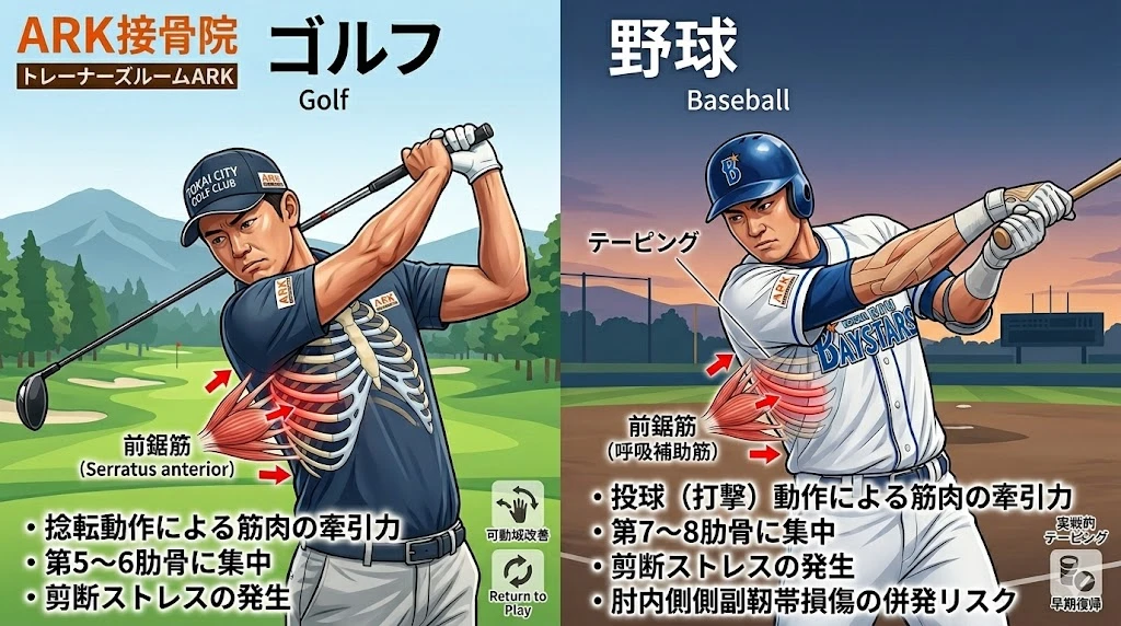 知多市でゴルフと野球での疲労骨折の痛み