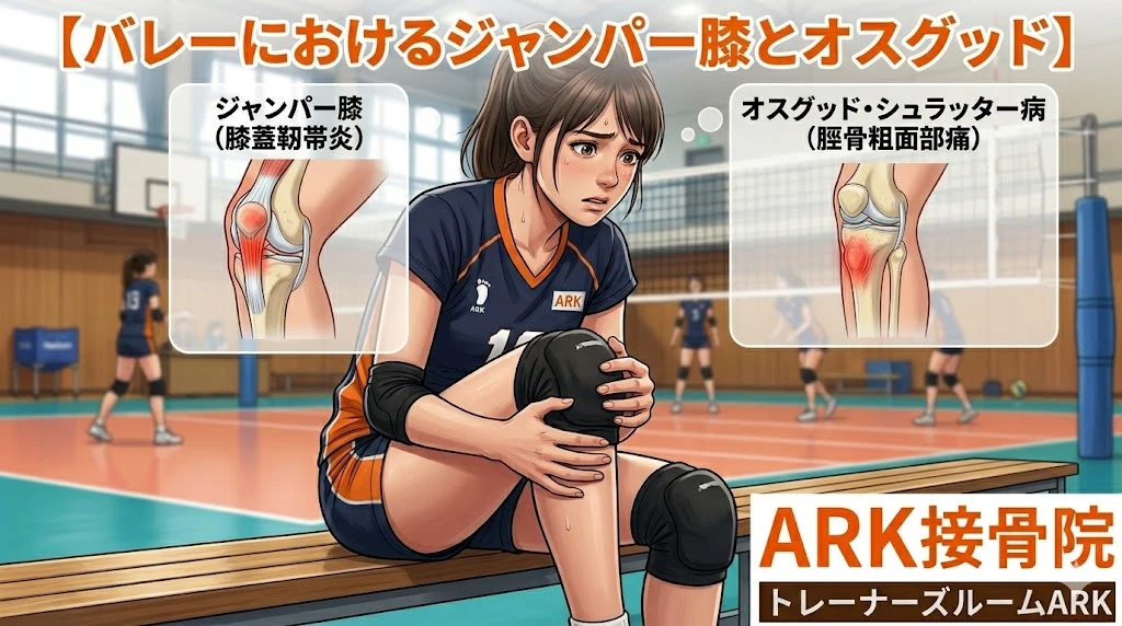 東海市でバレーボール選手に多いジャンパー膝とオスグッド