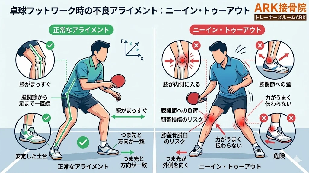 東海市で膝の痛みの解説