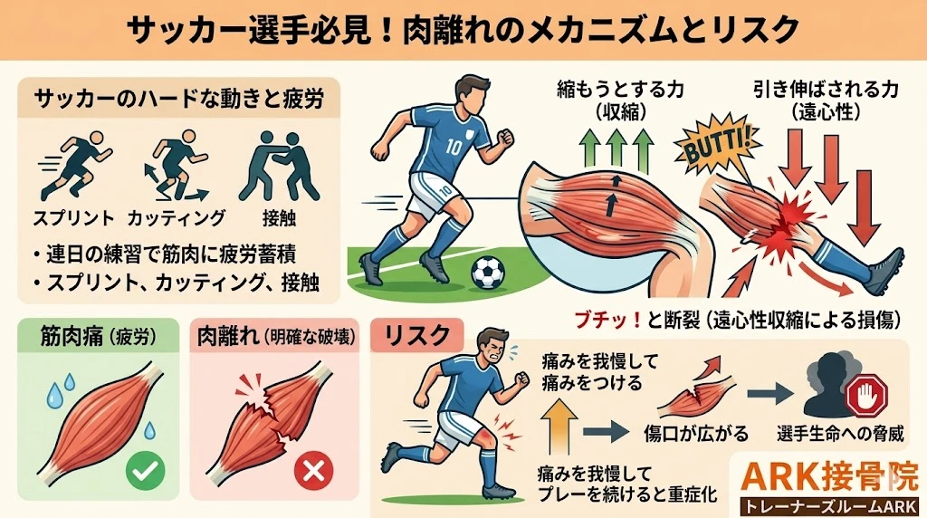大府市でさっかーでの太ももの痛みは肉離れかもしれない
