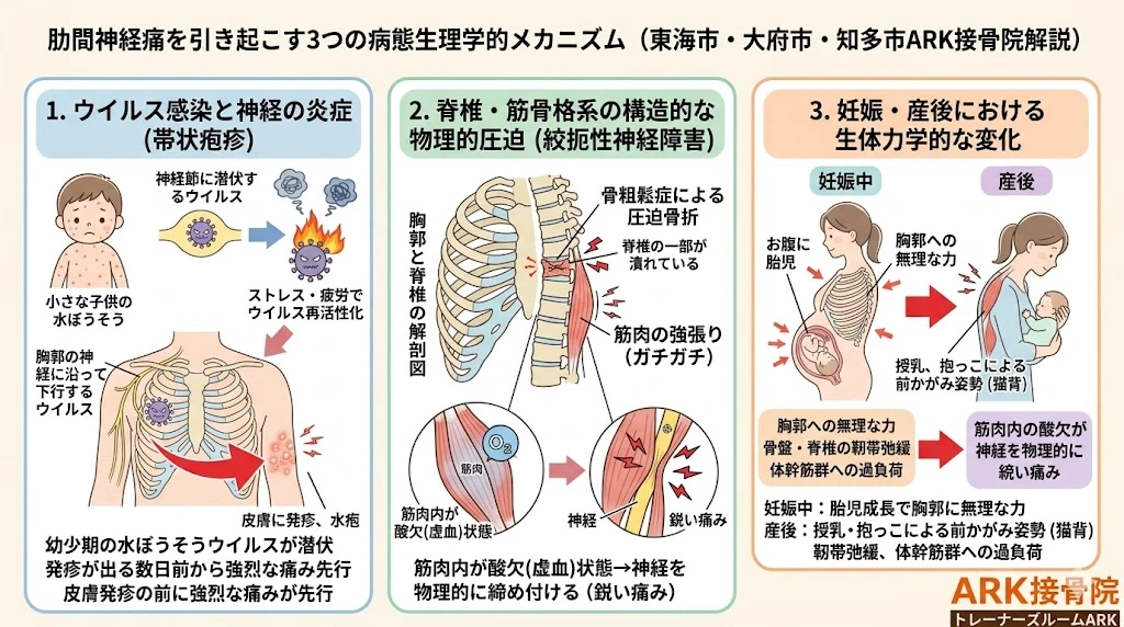 大府市で肋間神経痛の脇の痛み