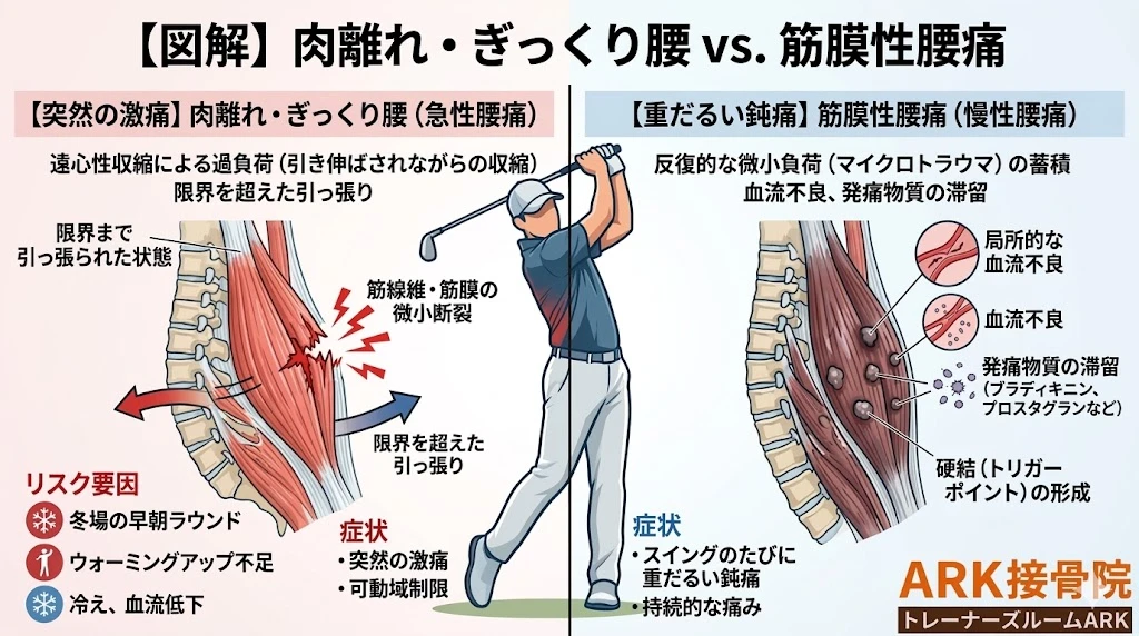 東海市でゴルフによる背中の痛み