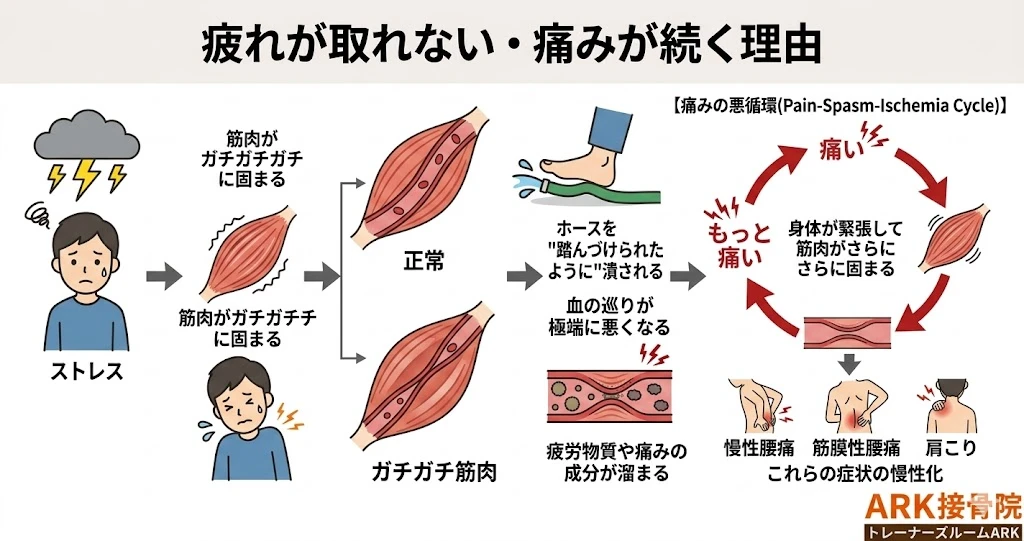 東海市で自律神経の乱れによる肩こり