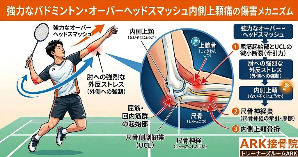 知多市でラケットを振った際肩が痛いときの対処