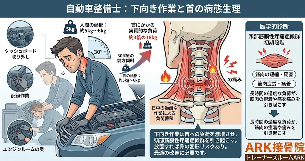 東海市で下向き作業を行う自動車整備士に起こる首の痛み
