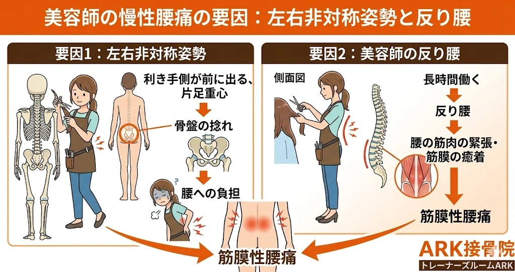 東海市で長時間立位での筋膜性腰痛