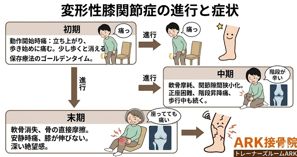 知多市で変形性膝関節症の痛みへのアプローチ