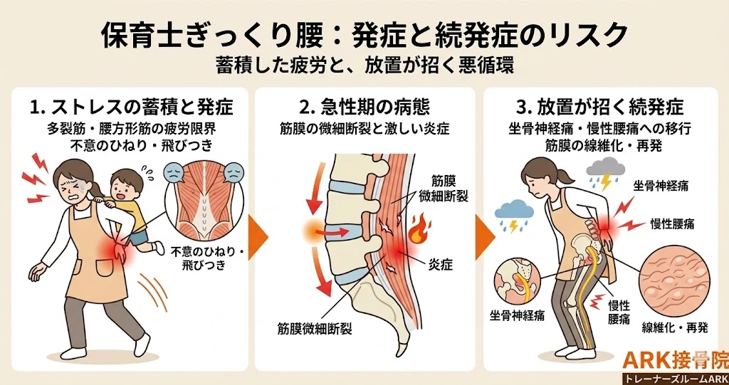 東海市で保育士のぎっくり腰