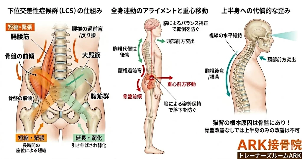 東海市で姿勢不全による脚の痛み