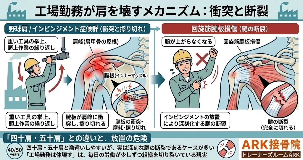 東海市で日本製鉄での肩の痛み
