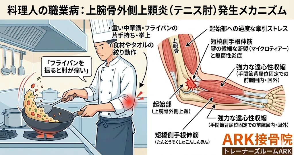 東海市で料理をするためにフライパンを振ると肘が痛い