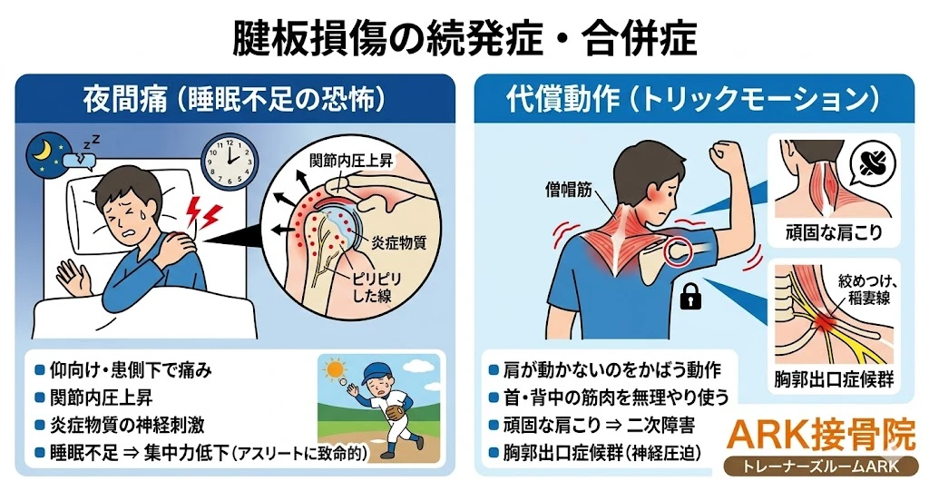 大府市で腱板損傷と四十肩の違いを解説