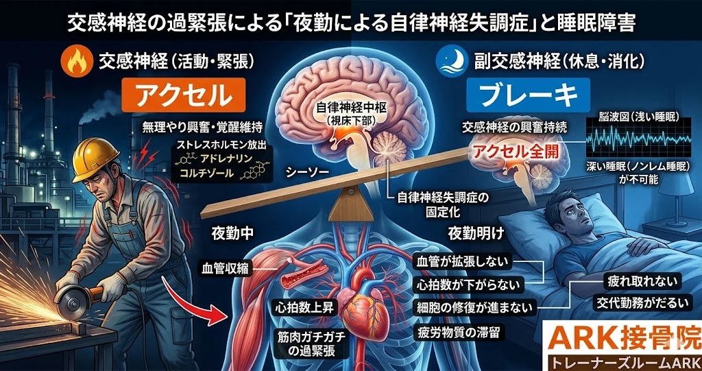 大府市で製鉄業の人が陥る寝不足