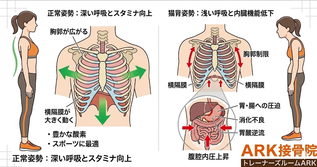 大府市で姿勢不全による猫背と頭痛