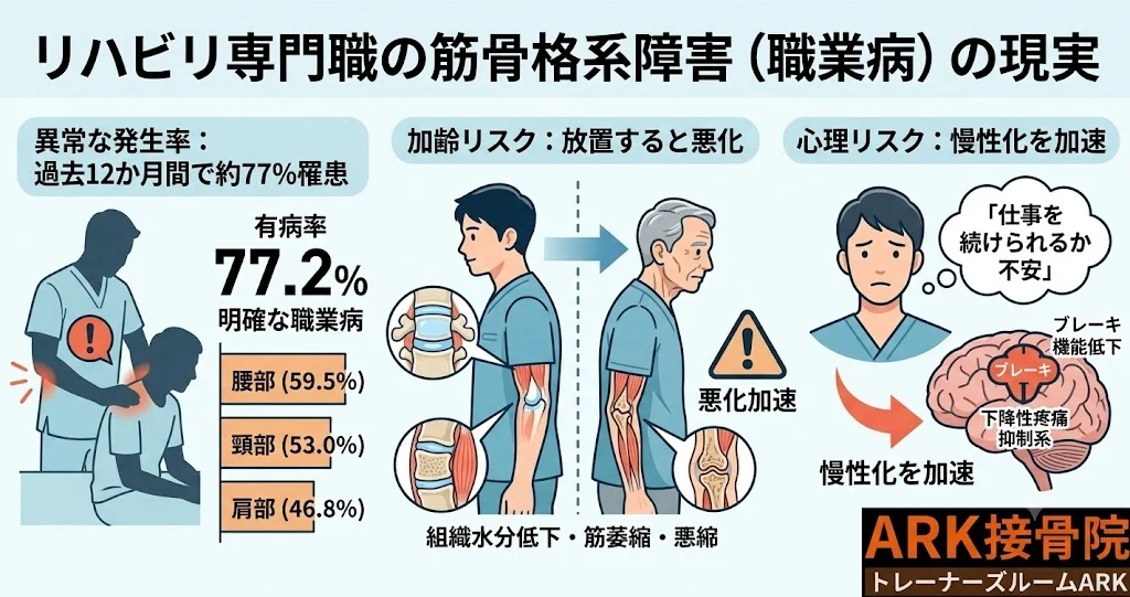 知多市でリハビリ職に多い筋膜性腰痛