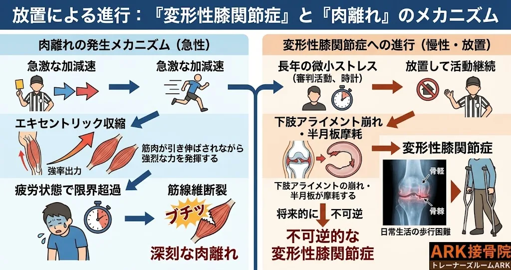 大府市でサッカーの審判員に多い膝の痛み