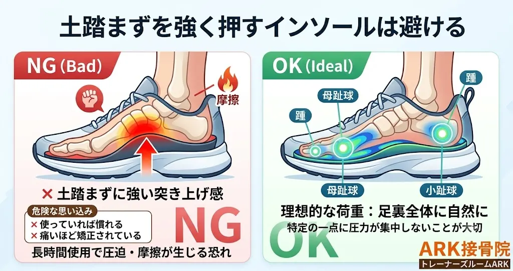 大府市で土踏まずが突き上げで痛い