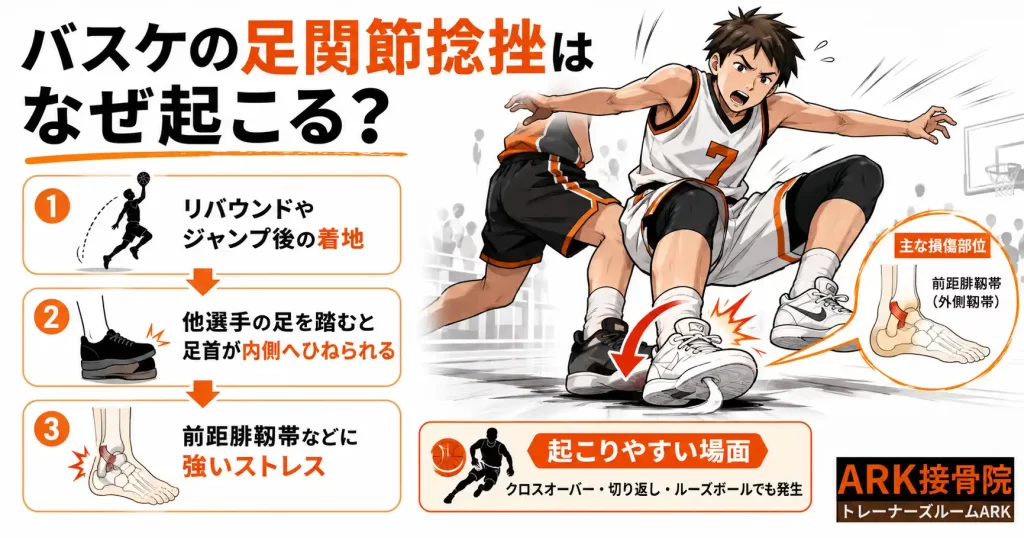 バスケットボールでよく起こる足関節捻挫の解説