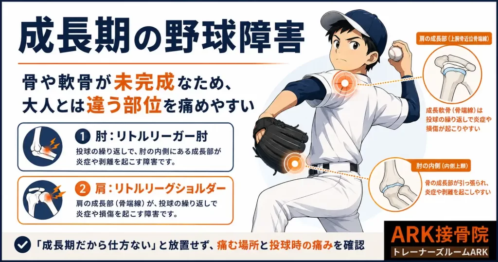 成長期の野球障害