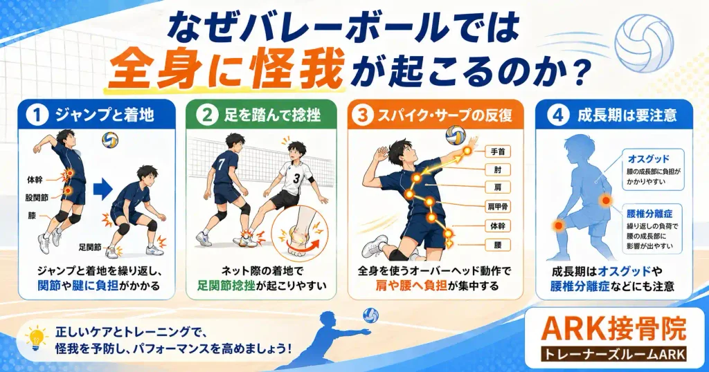 バレーボールで怪我が起こる仕組み