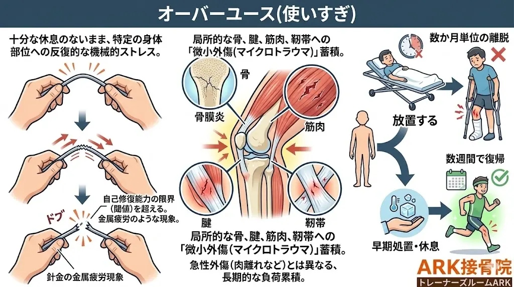 新体操におけるオーバーユース